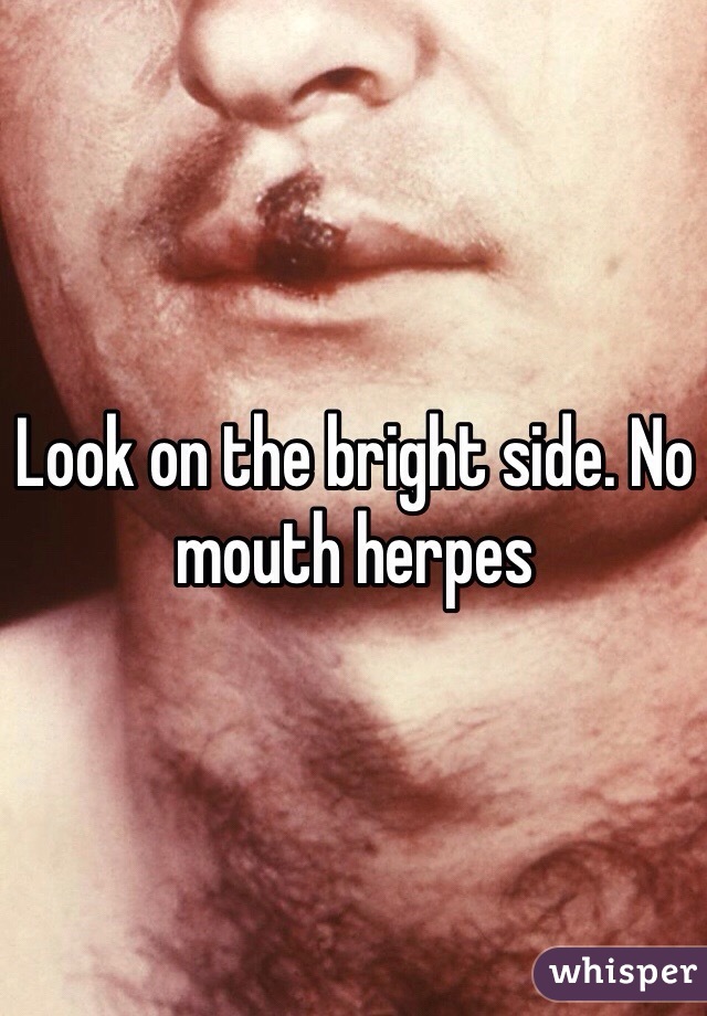 Look on the bright side. No mouth herpes 