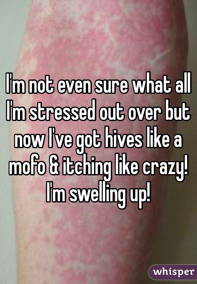 I'm not even sure what all I'm stressed out over but now I've got hives like a mofo & itching like crazy! I'm swelling up!