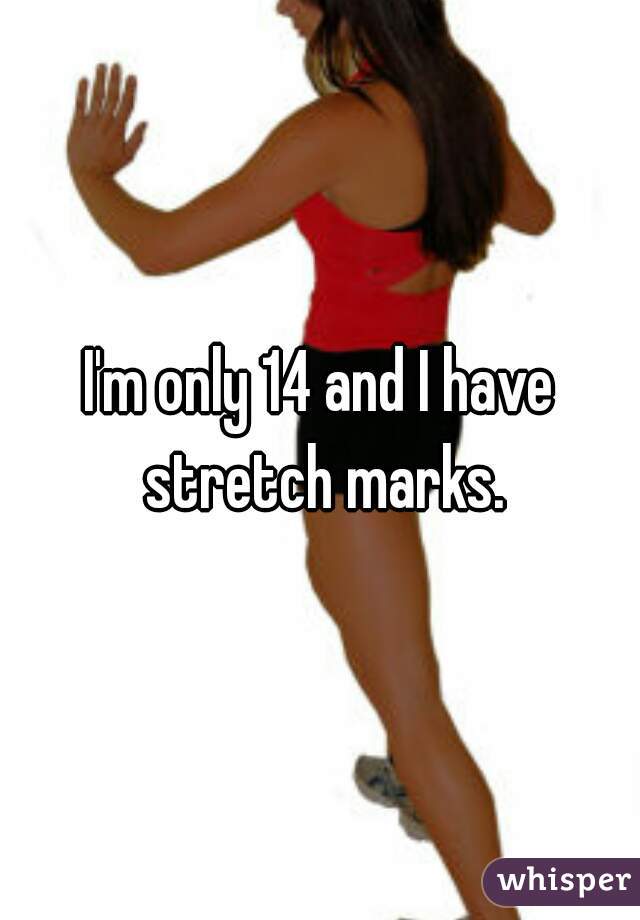 I'm only 14 and I have stretch marks.