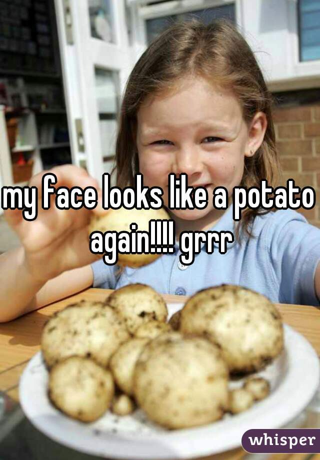 my face looks like a potato again!!!! grrr