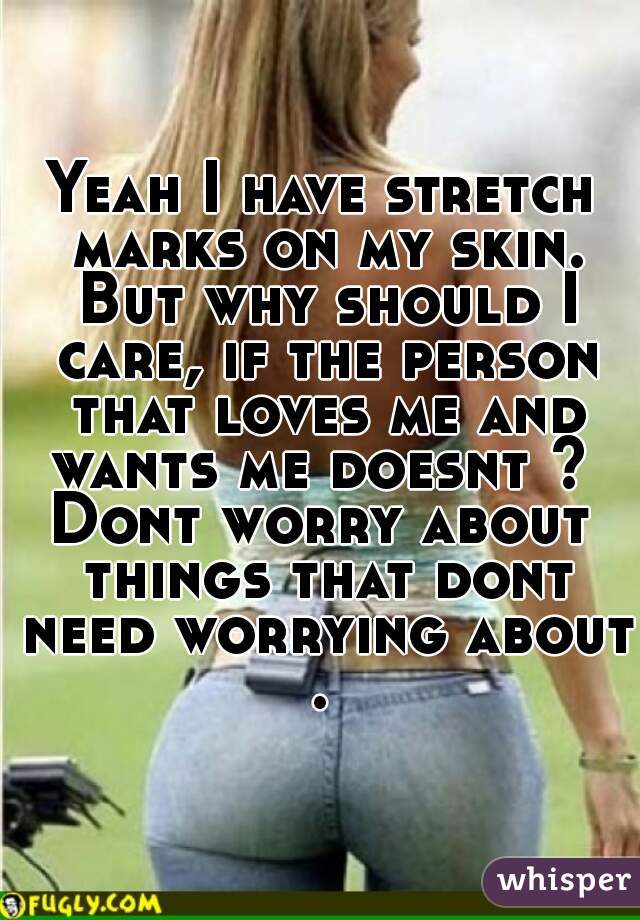 Yeah I have stretch marks on my skin. But why should I care, if the person that loves me and wants me doesnt ? 
Dont worry about things that dont need worrying about . 