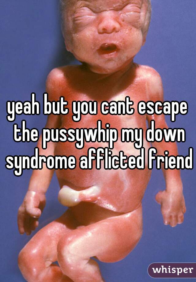 yeah but you cant escape the pussywhip my down syndrome afflicted friend