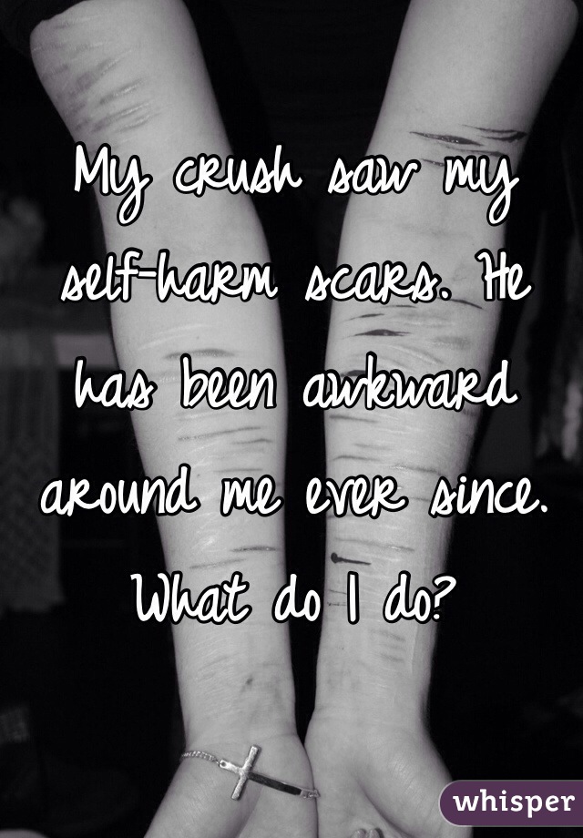 My crush saw my self-harm scars. He has been awkward around me ever since. 
What do I do? 