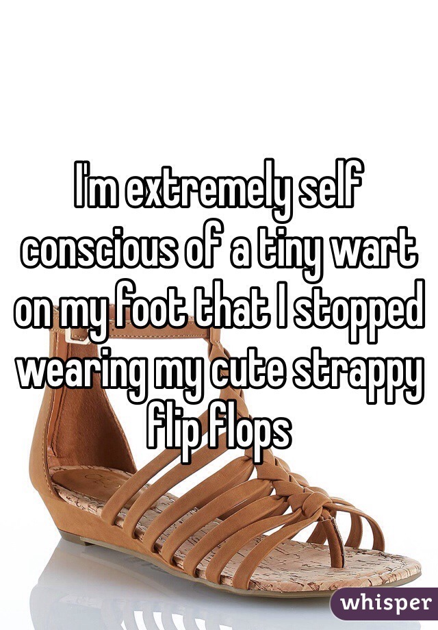 I'm extremely self conscious of a tiny wart on my foot that I stopped wearing my cute strappy flip flops