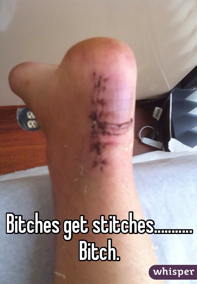 Bitches get stitches........... Bitch.