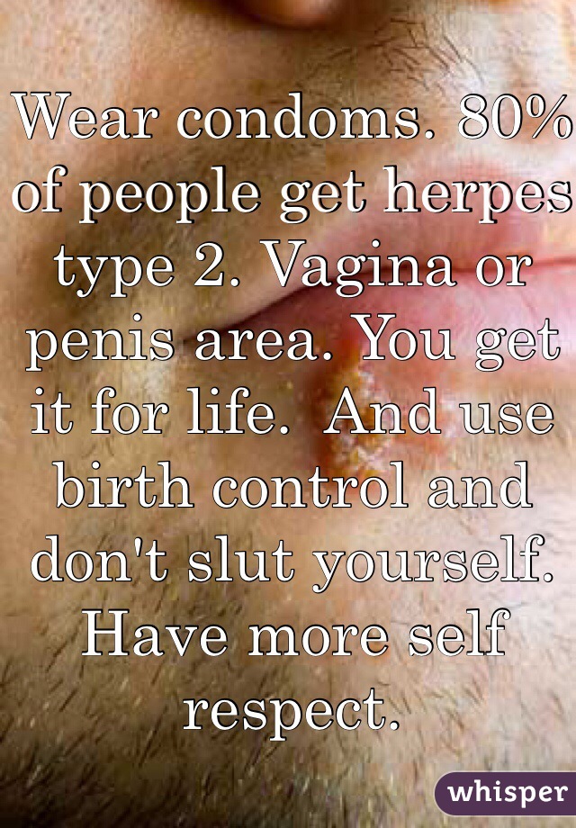 Wear condoms. 80% of people get herpes type 2. Vagina or penis area. You get it for life.  And use birth control and don't slut yourself. Have more self respect. 