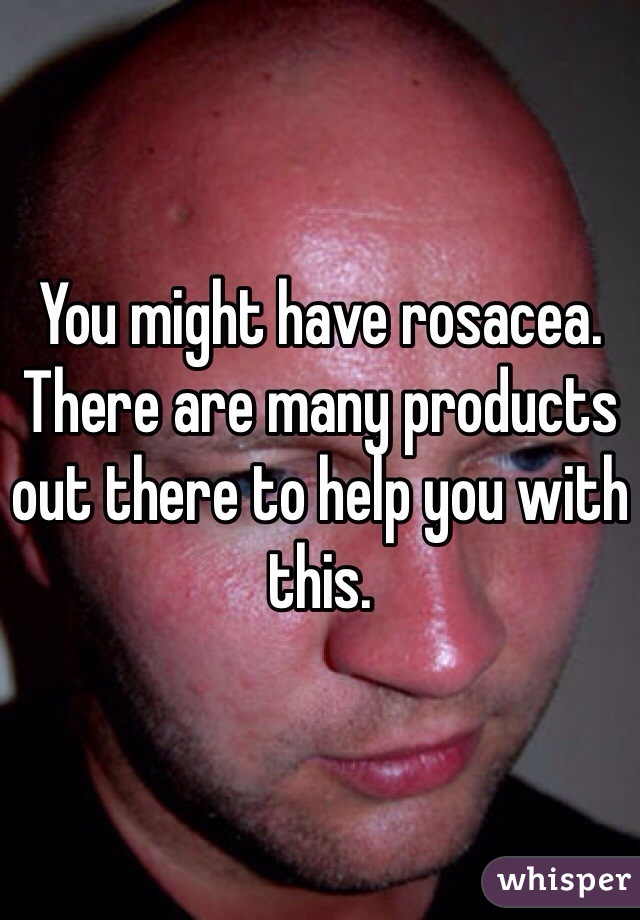 You might have rosacea. There are many products out there to help you with this.  