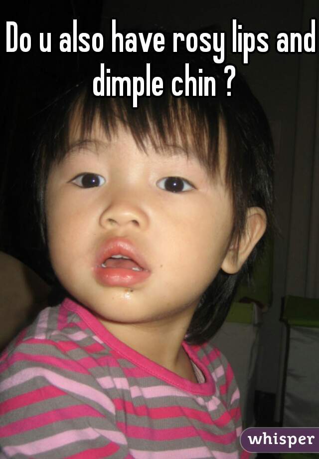 Do u also have rosy lips and dimple chin ?
