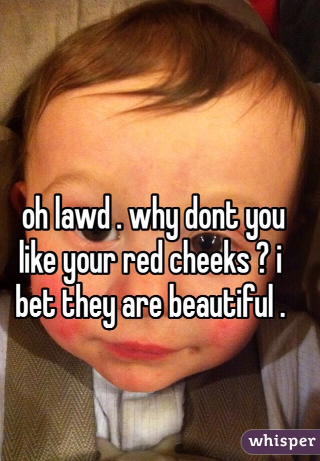  oh lawd . why dont you like your red cheeks ? i bet they are beautiful .