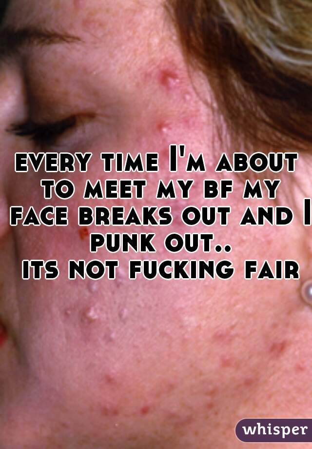every time I'm about to meet my bf my face breaks out and I punk out..
 its not fucking fair