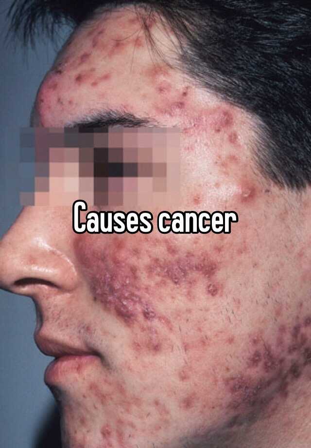 causes-cancer