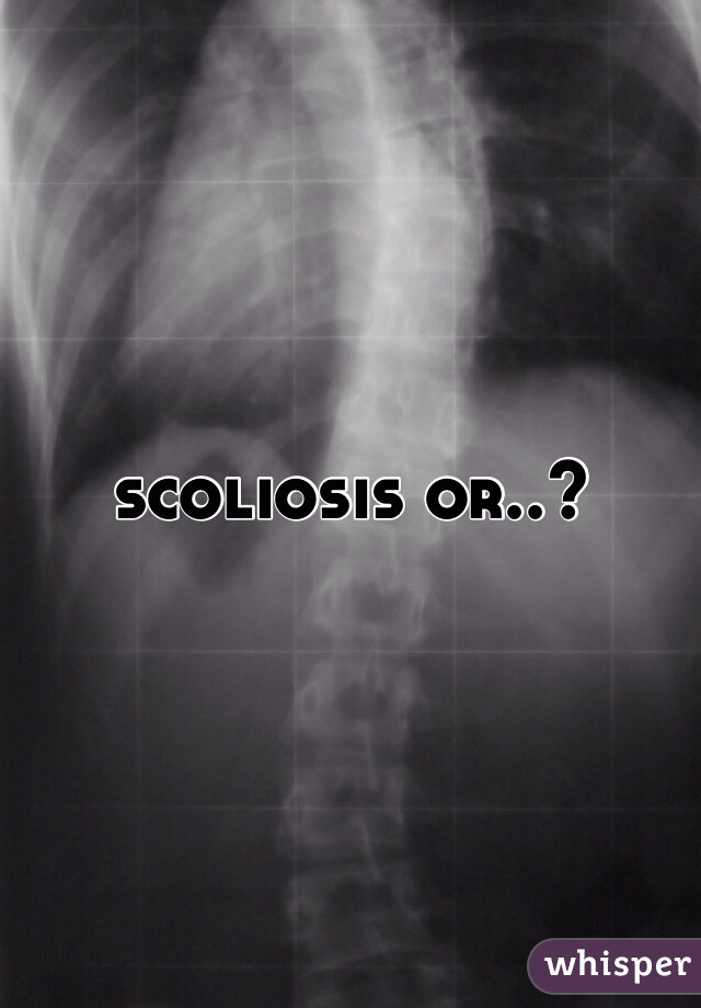 scoliosis or..?