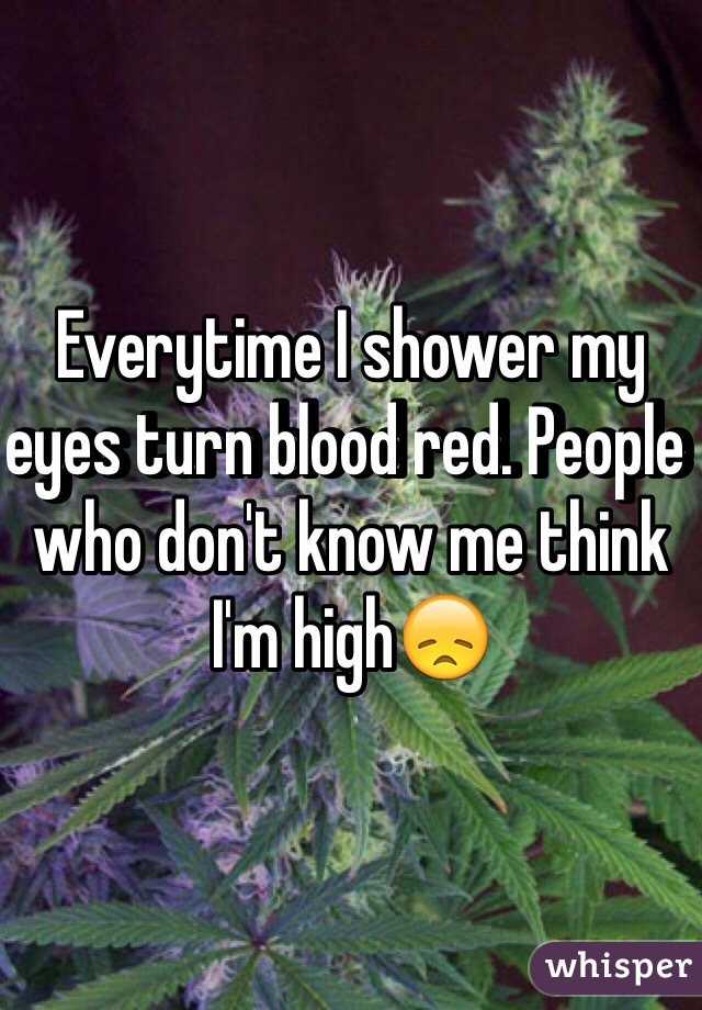 Everytime I shower my eyes turn blood red. People who don't know me think I'm high😞