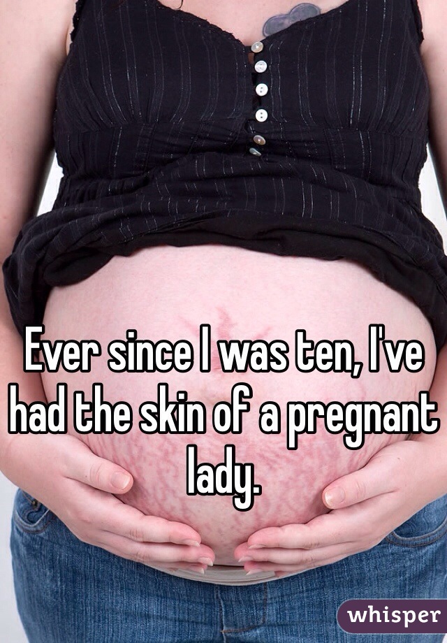 Ever since I was ten, I've had the skin of a pregnant lady. 