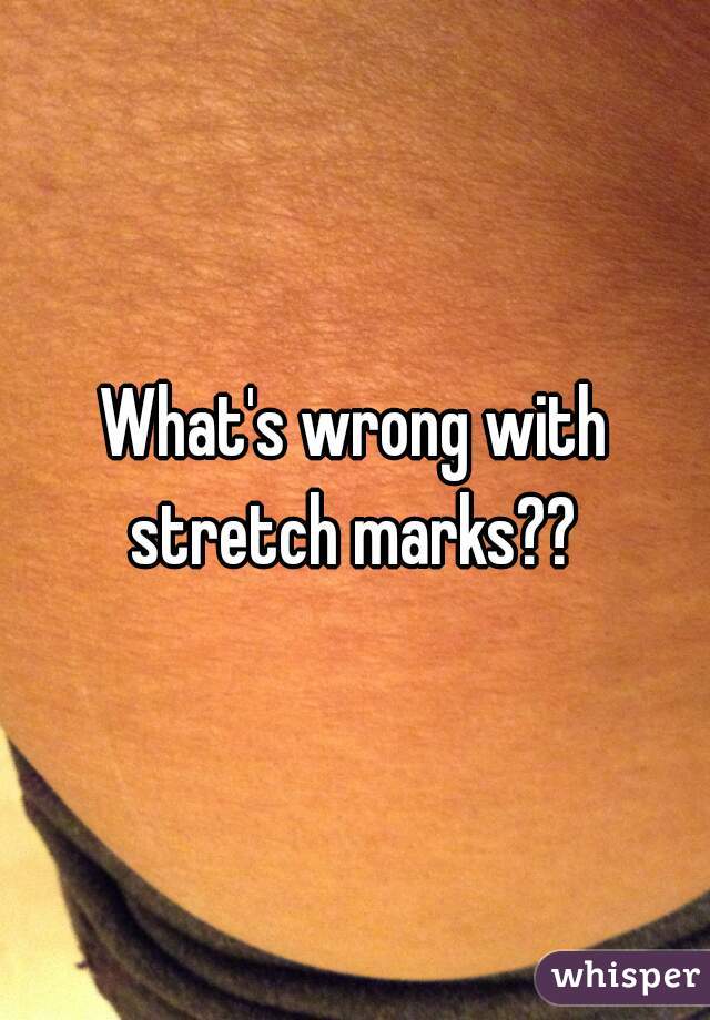 What's wrong with stretch marks?? 