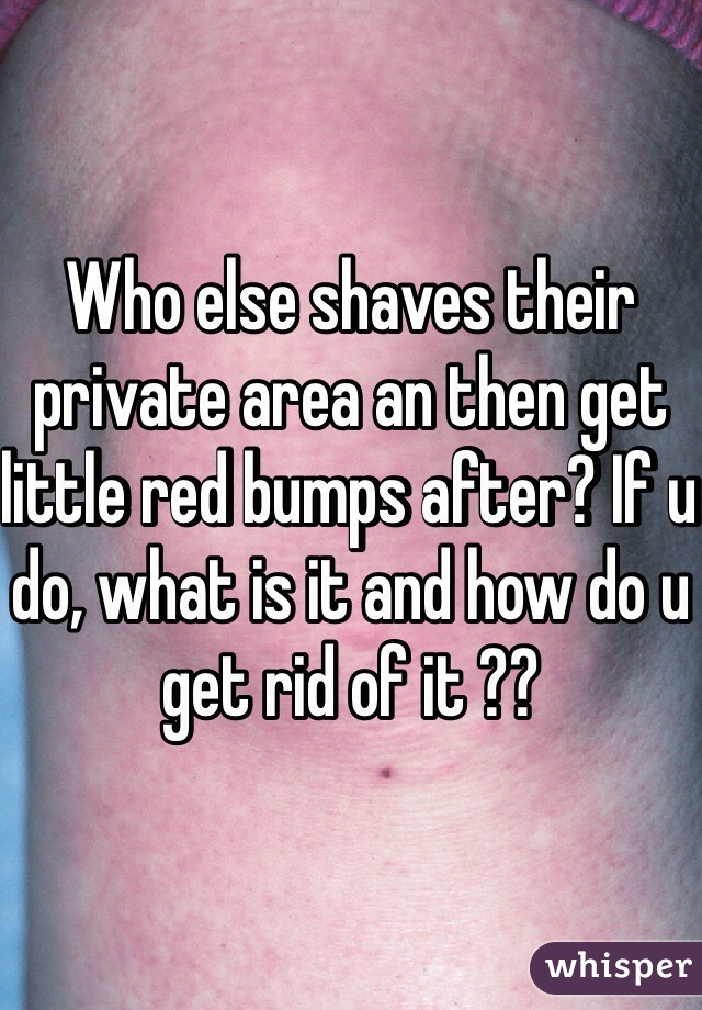 Who else shaves their private area an then get little red bumps after? If u do, what is it and how do u get rid of it ??