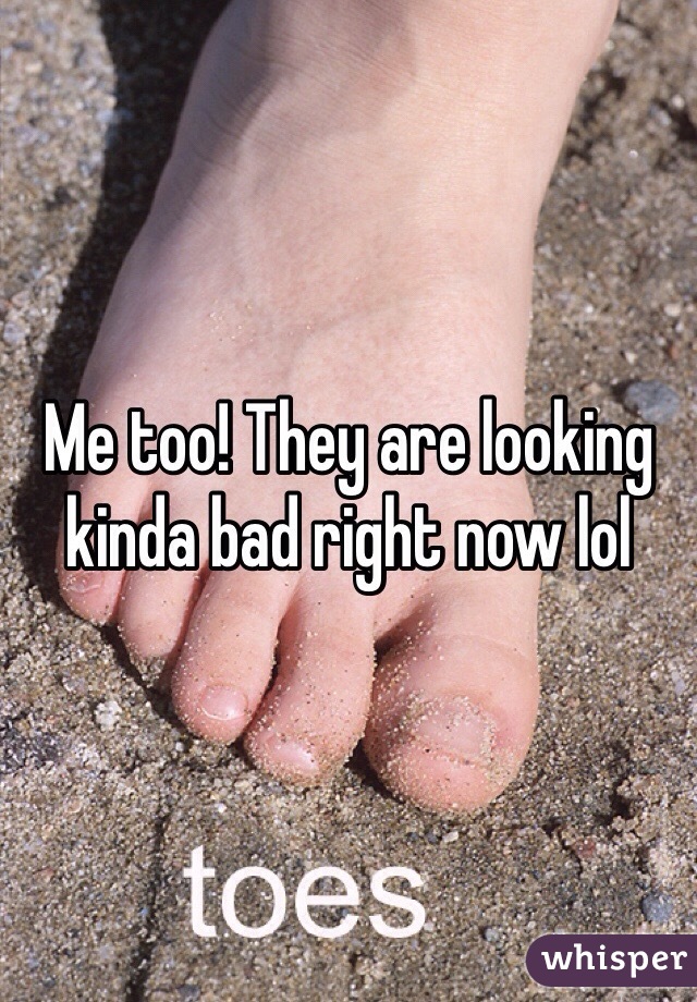 Me too! They are looking kinda bad right now lol 