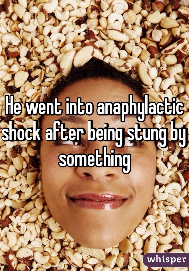 He went into anaphylactic shock after being stung by something  