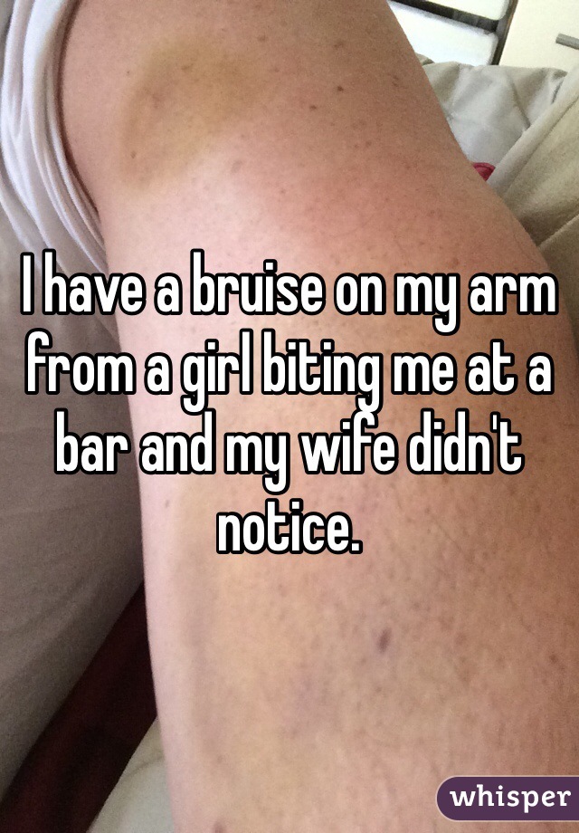 I have a bruise on my arm from a girl biting me at a bar and my wife didn't notice. 