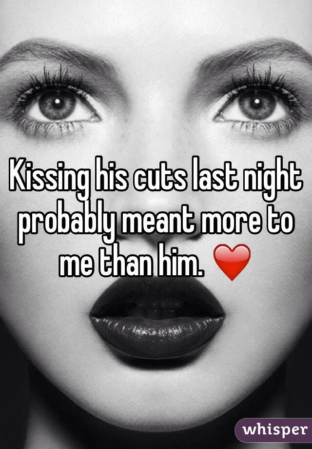 Kissing his cuts last night probably meant more to me than him. ❤️