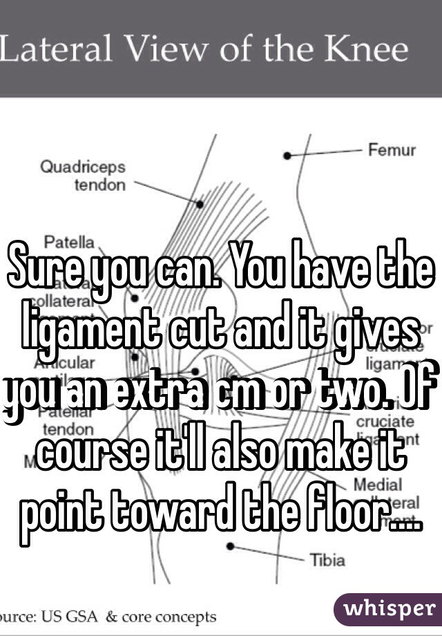 Sure you can. You have the ligament cut and it gives you an extra cm or two. Of course it'll also make it point toward the floor....