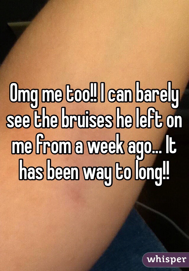 Omg me too!! I can barely see the bruises he left on me from a week ago... It has been way to long!!