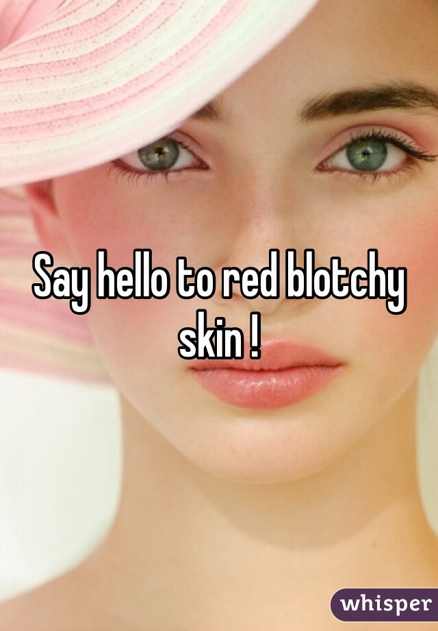 Say hello to red blotchy skin ! 