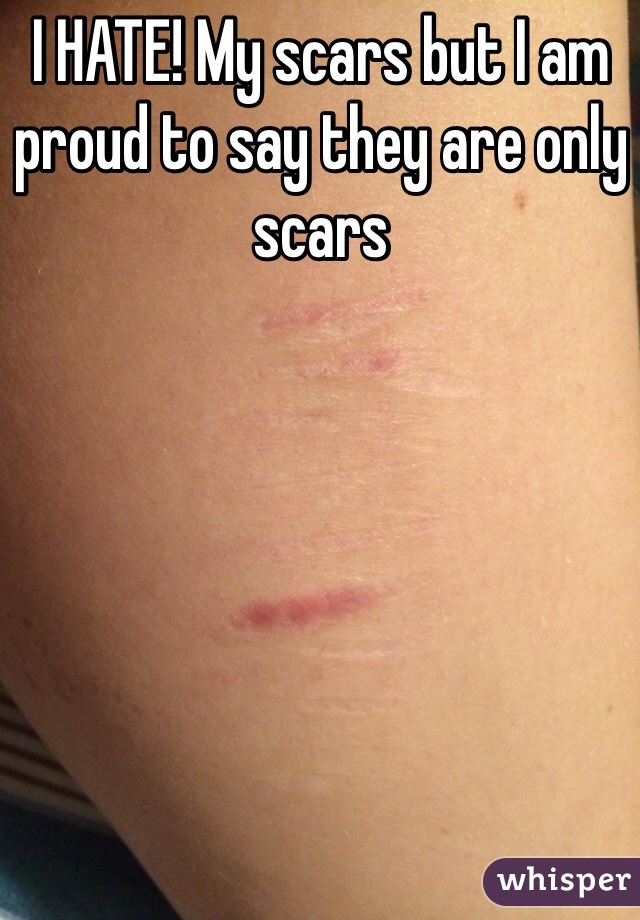 I HATE! My scars but I am proud to say they are only scars
