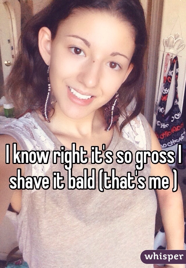 I know right it's so gross I shave it bald (that's me )
