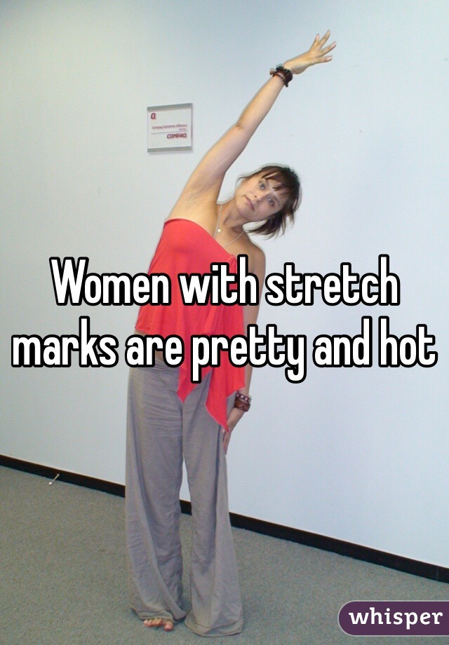 Women with stretch marks are pretty and hot 