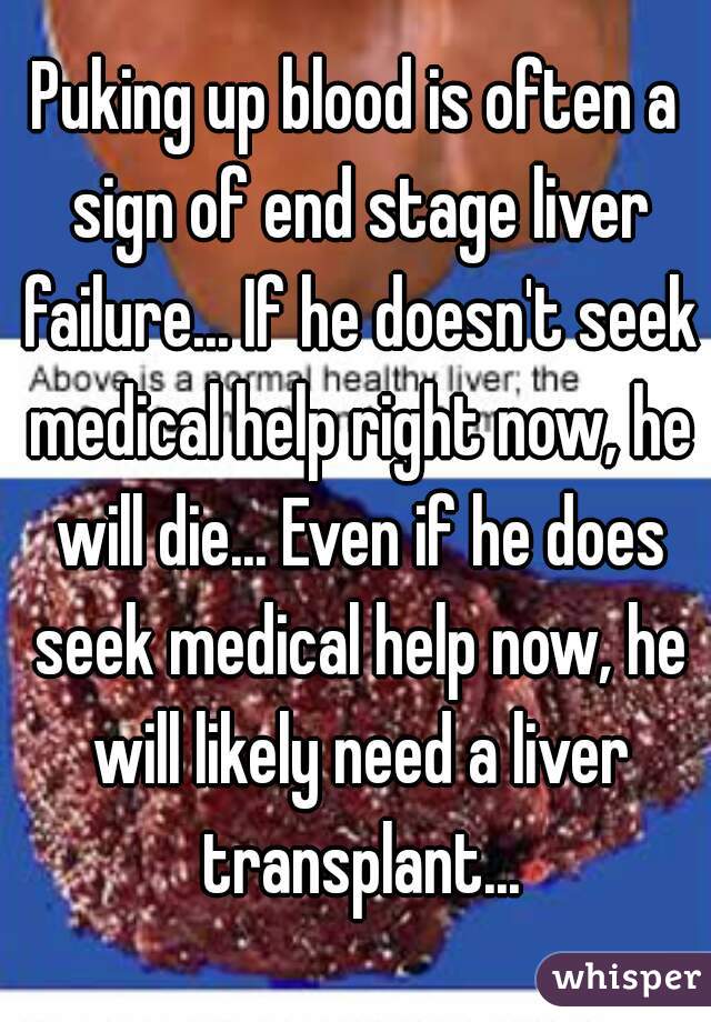 Puking up blood is often a sign of end stage liver failure... If he doesn't seek medical help right now, he will die... Even if he does seek medical help now, he will likely need a liver transplant...