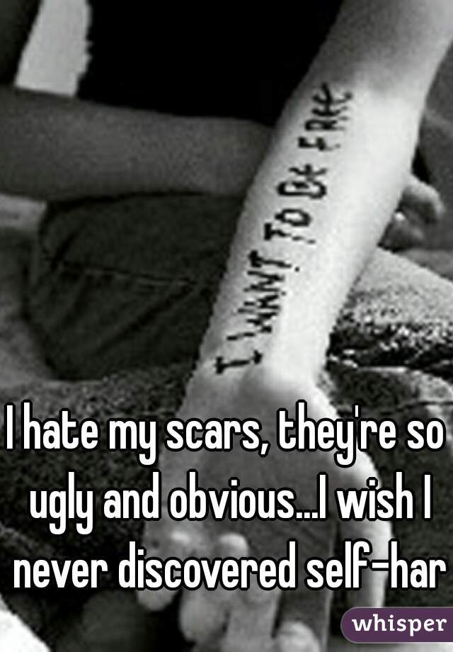 I hate my scars, they're so ugly and obvious...I wish I never discovered self-harm