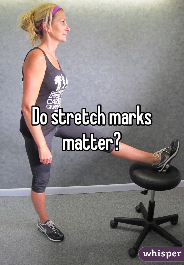 Do stretch marks matter? 