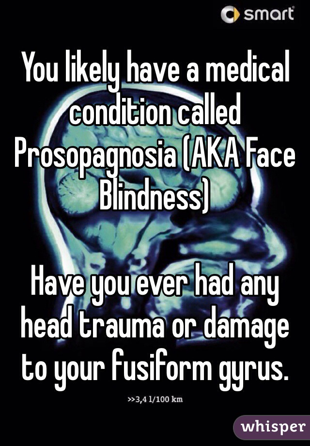 You likely have a medical condition called Prosopagnosia (AKA Face Blindness)

Have you ever had any head trauma or damage to your fusiform gyrus. 