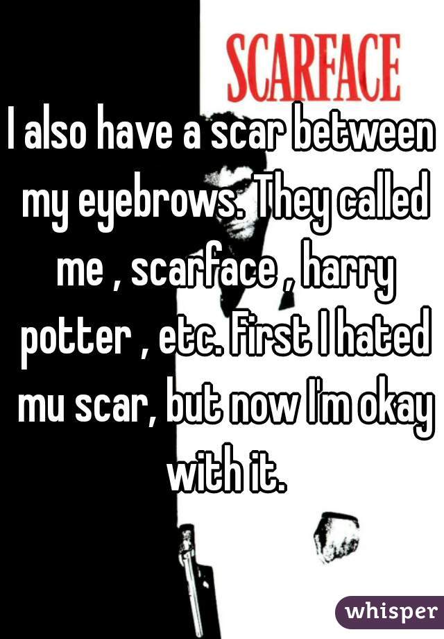 I also have a scar between my eyebrows. They called me , scarface , harry potter , etc. First I hated mu scar, but now I'm okay with it.