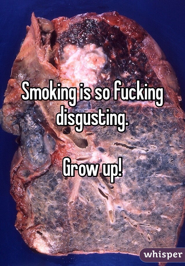 Smoking is so fucking disgusting.

Grow up!