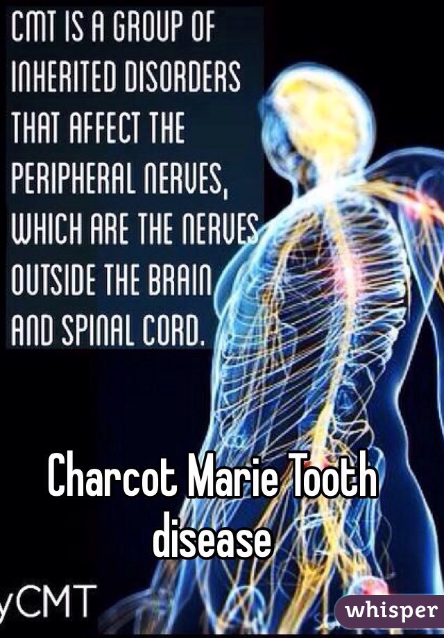 Charcot Marie Tooth disease