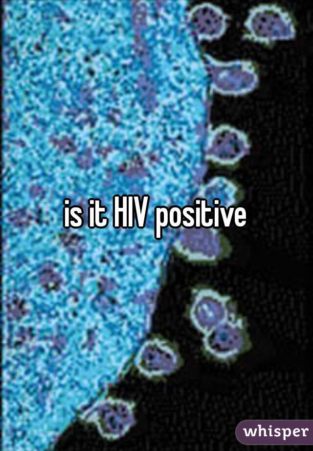 is it HIV positive