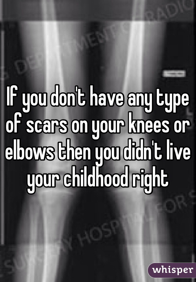 If you don't have any type of scars on your knees or elbows then you didn't live your childhood right