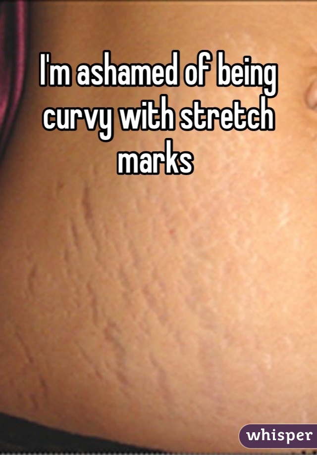 I'm ashamed of being curvy with stretch marks 