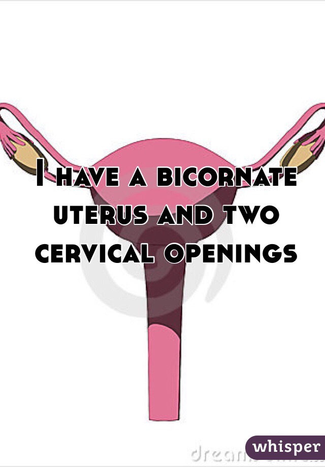 I have a bicornate uterus and two cervical openings