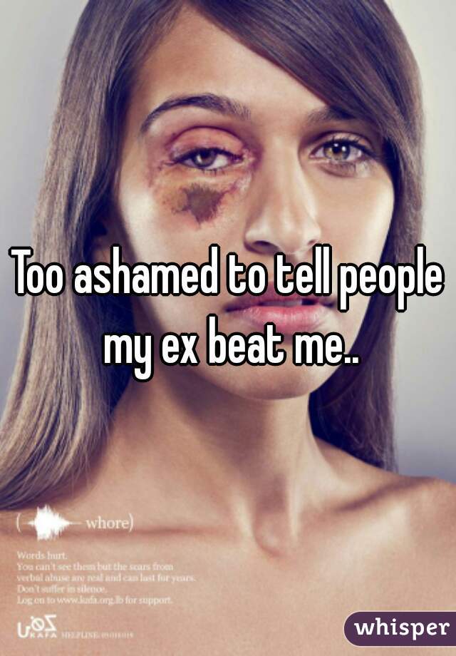 Too ashamed to tell people my ex beat me..