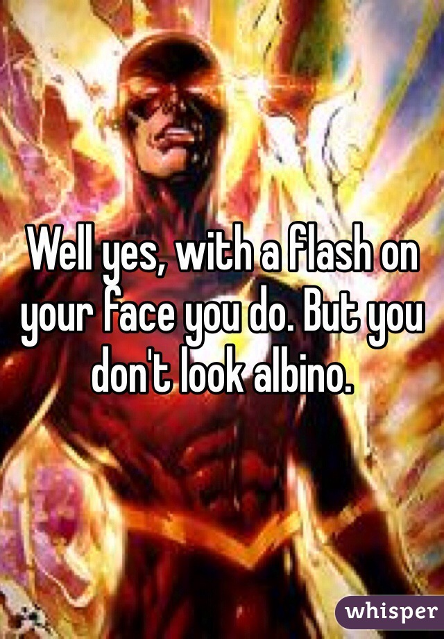 Well yes, with a flash on your face you do. But you don't look albino. 