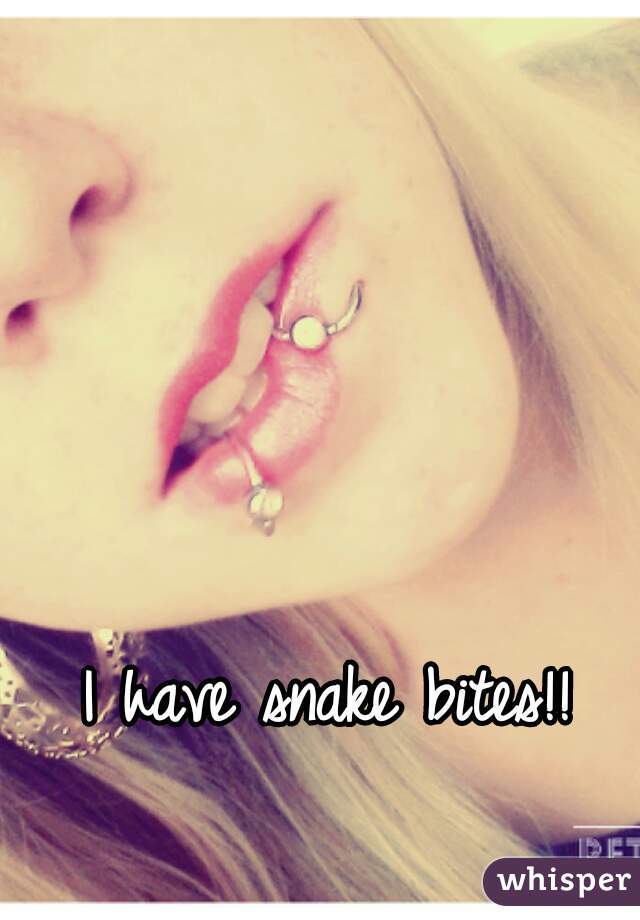 I have snake bites!!