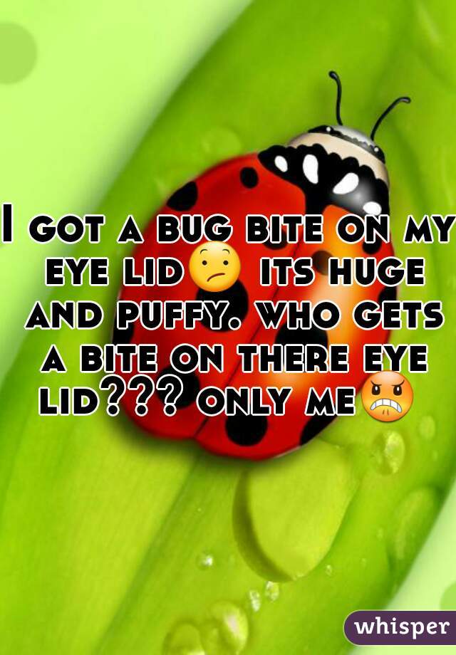 I got a bug bite on my eye lid😕 its huge and puffy. who gets a bite on there eye lid??? only me😠  