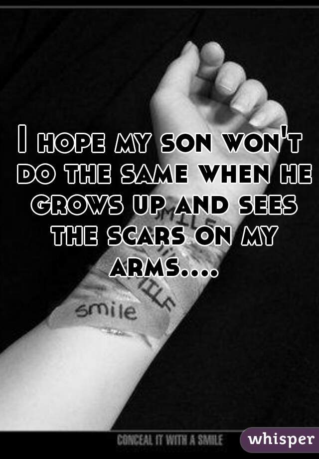 I hope my son won't do the same when he grows up and sees the scars on my arms....  