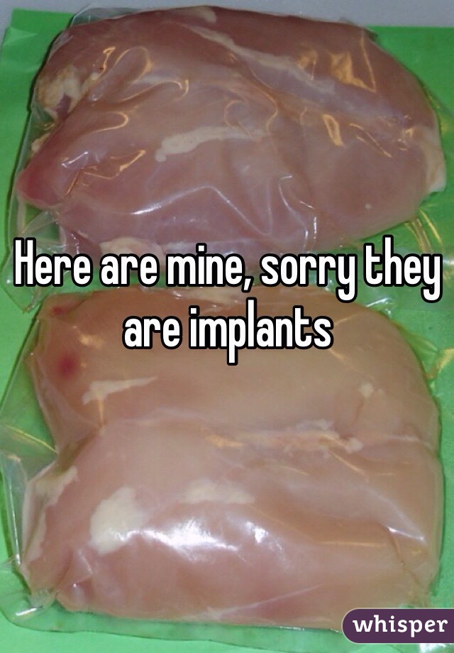 Here are mine, sorry they are implants 