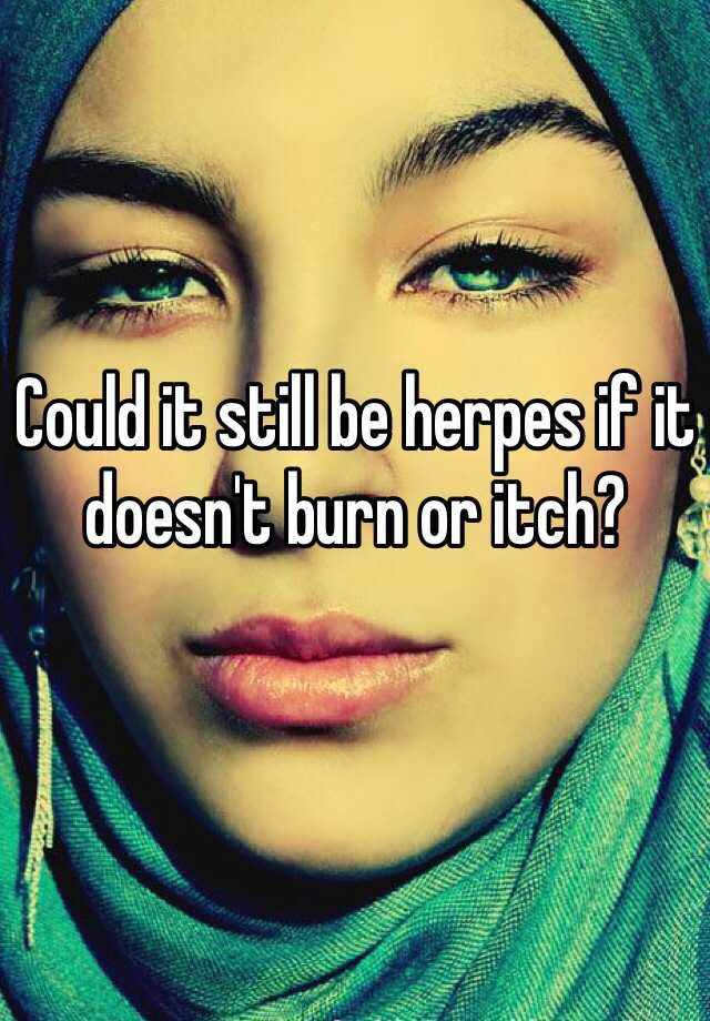 could-it-still-be-herpes-if-it-doesn-t-burn-or-itch