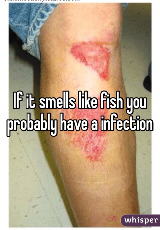 If it smells like fish you probably have a infection