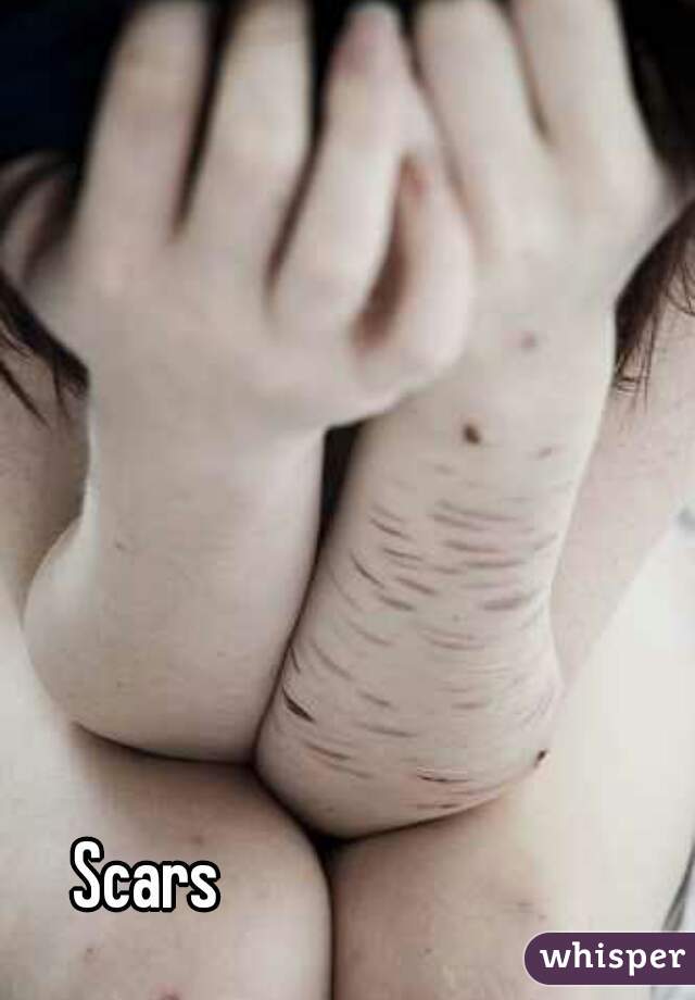 Scars 